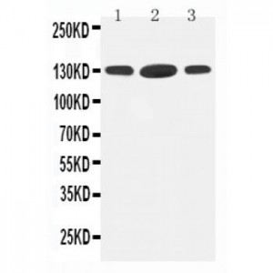 HDAC6 Antibody