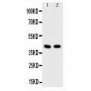 HDAC8 Antibody