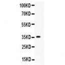 HIF-1-alpha  Antibody