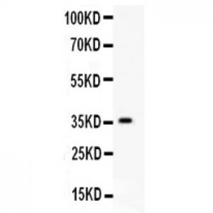 HIF-1-alpha  Antibody