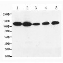 HIF-1-alpha Antibody