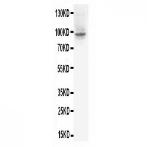 HIF-2-alpha Antibody