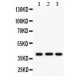 HLA A  Antibody