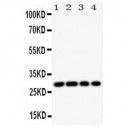 HLA DMB Antibody