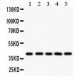 HLA-C  Antibody