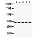 HSD11B1 Antibody