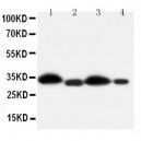 HSD11B1 Antibody