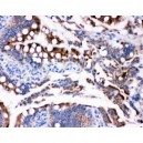 HSD17B2 Antibody