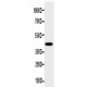 HSD17B2 Antibody