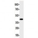 HSD17B2 Antibody