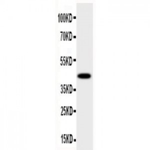 HSD17B2 Antibody