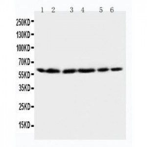 HSP60 Antibody