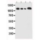 human CEACAM5 Antibody