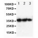 human EPO Antibody