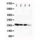 human FGF1 Antibody