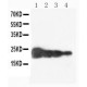 human Growth Hormone Antibody