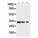 human Survivin Antibody