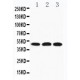 HYAL3 Antibody