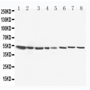 Hydroxysteroid(17-beta) Dehydrogenase 4 Antibody