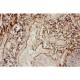 ICAM1  Antibody