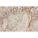 ICAM1  Antibody