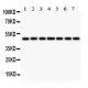 IDH1  Antibody