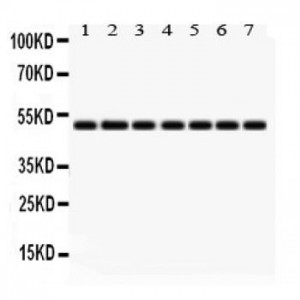 IDH2  Antibody