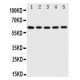 Iduronate 2 sulfatase Antibody