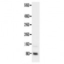 IGF1 Antibody