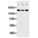 IGF1 Receptor Antibody