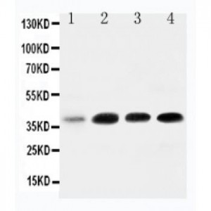 IGFBP3 Antibody