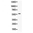 Ikaros  Antibody