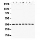 IKB alpha  Antibody