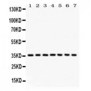 IKB alpha  Antibody