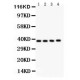 IKB beta  Antibody