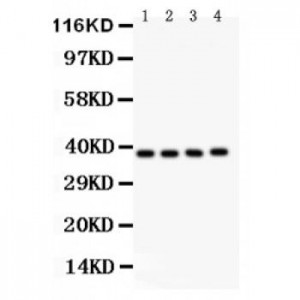 IKB beta  Antibody