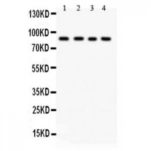 IKK beta  Antibody