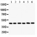 IL2RA Antibody