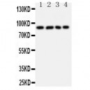 IL4R Antibody