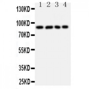 IL4R Antibody