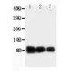 IL-8 Antibody