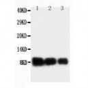 IL-8 Antibody