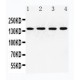 INPPL1 Antibody