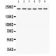 Integrin alpha 4  Antibody