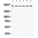 Integrin alpha 4  Antibody