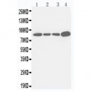 Integrin beta 3 Antibody