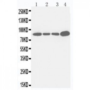 Integrin beta 3 Antibody