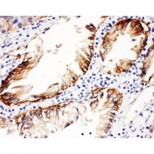 Integrin beta 4  Antibody