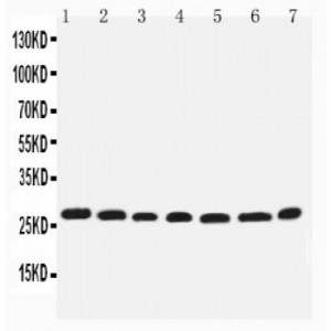 integrin beta 4 binding protein Antibody