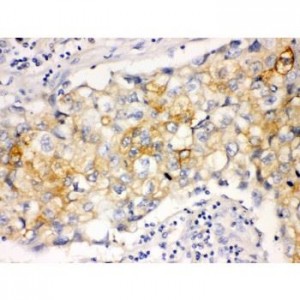 Involucrin Antibody (monoclonal)